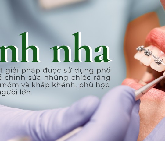 Niềng răng mắc cài